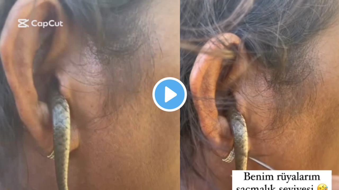 snake in ear viral video